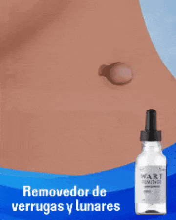 WART REMOVER™
